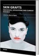 Skin Grafts - Indications, Applications and Current Research by Marcia Spear